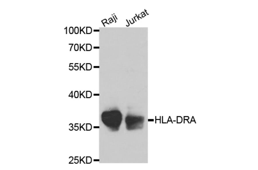 AntiHLADRA Antibody (A36779)